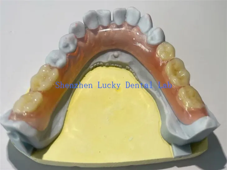 Удобне делимичне флексибилне произвођаче зубне протезе