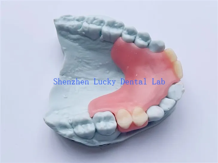 Прилагођена стоматолошка делимична флексибилна протеза Пробачаји