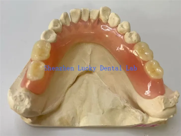 Дјеломична флексибилна зубна лабораторија за зубну протезу