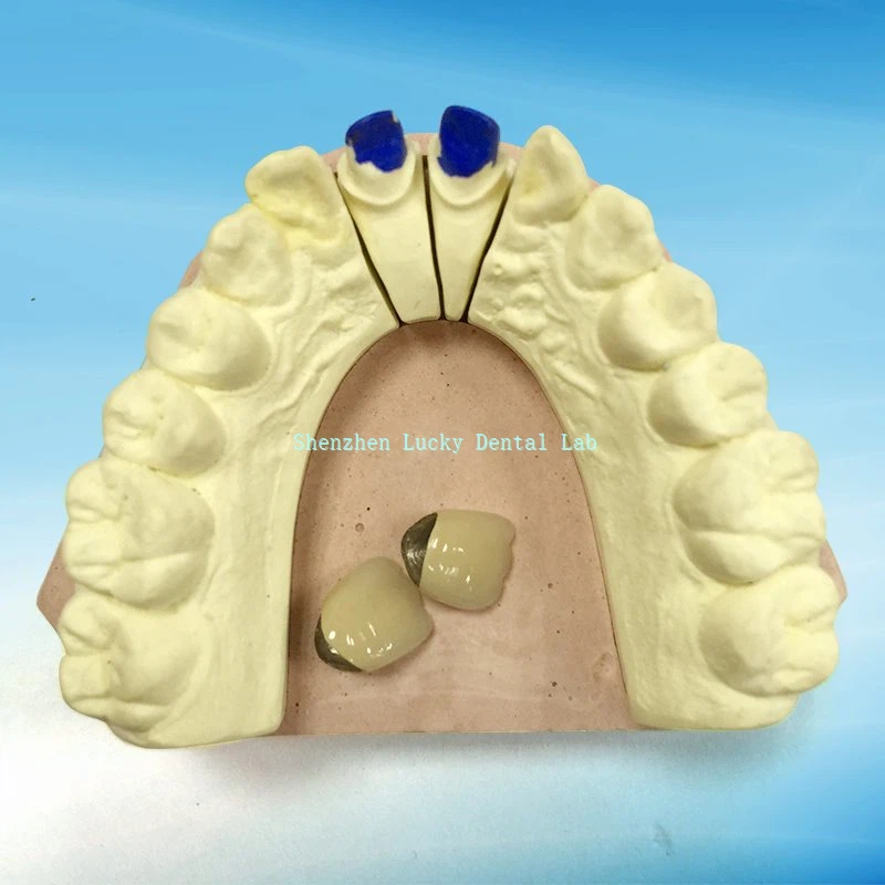 Полу - драгоцена метална паладијум - сребрна круна