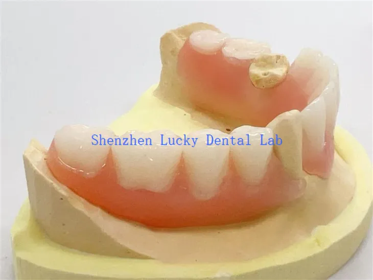 Делимична флексибилна зубна протеза високог квалитета