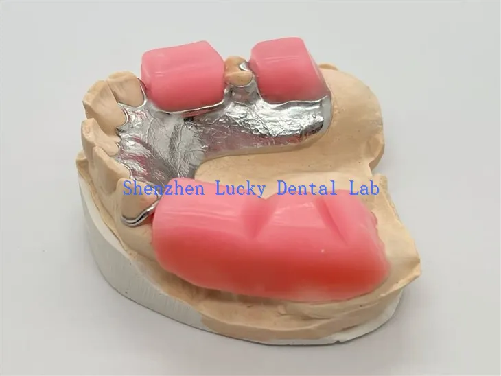 Метални оквир са угризним блоком